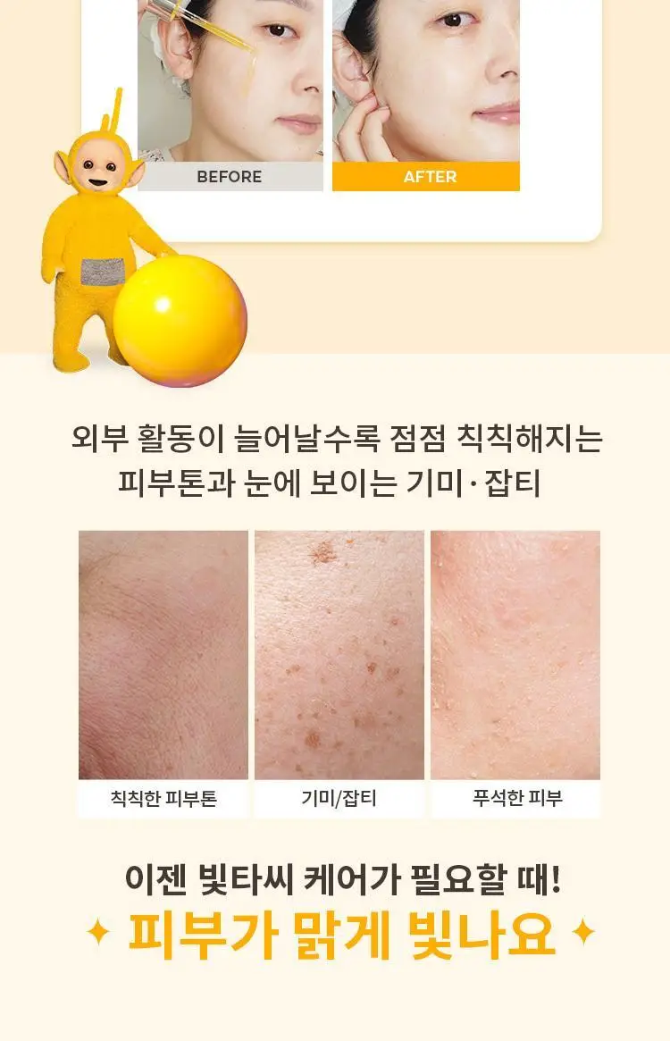 [NEW] 미샤 텔레토비 콜라보 비타씨플러스 잡티씨 탄력 앰플 30ml 키링 기획 상세페이지 10